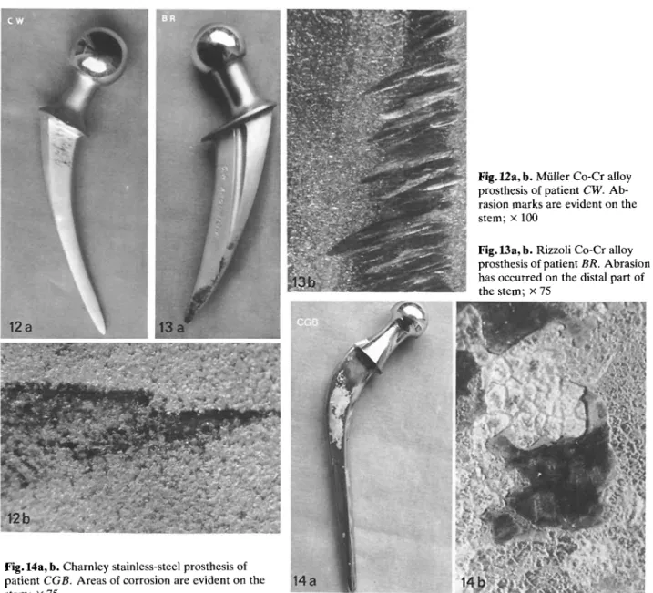 Fig  12 a,  b  Miller  Co-Cr alloy