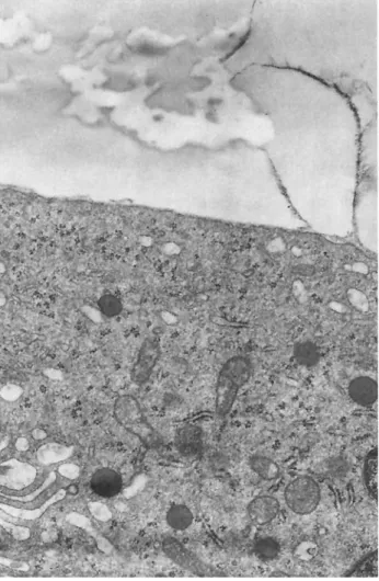 Fig  8  Ultrastructural  detail  of  a  cell  surrounding  a  methyl- methyl-methacrylate  globule  The  cell  shows  a  well-developed   granu-lar  endoplasmic  reticulum,  ribosomes  and mitochondria  The cell  membrane  is uninterrupted  and  a thin fib