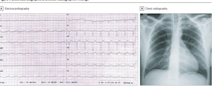 Figure 1. Electrocardiographic and Chest Radiographic Findings
