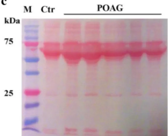 Fig. 1 Experimental procedure and total protein analysis. a POAG and post-mortem TM specimens were simultaneously processed, according to the procedure reported in the ‘‘ Methods ’’ section