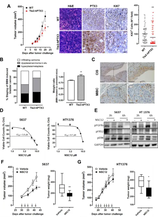 Figure 6. Stromal expression of  PTX3 and NSC12 treatment impair BC growth. (A) Tumor growth  and immunohistochemical analysis of MB49 cells grafted in wild-type (WT) or transgenic  hPTX3) mice
