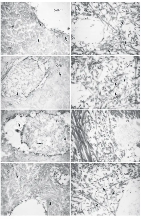 Figure  3.  Transmission  electron  micrographs  showing  immunolabelig  for:  a)  Dentin matrix protein 1 (DMP-1) in dentin of sound primary teeth used as controls; b) DMP-1 in  dentin  of  type  I  dentinogenesis  imperfecta (DGI-I)  affected  teeth;  c)