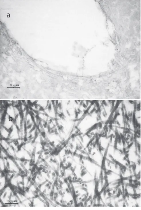 Figure 4. Representative images of the negative controls in dentin specimens of a) sound primary teeth; b) type I dentinogenesis imperfecta affected teeth.
