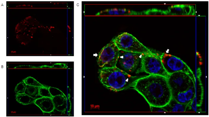 Figure 4: IgGH6 binds claudin3 on USPC-4 cell surface.  USPC4 cells were incubated 1 h at 4°C with 2.5 μg/mL of IgGH6 to  prevent antibody internalization, then cells were fixed, permeabilized, and incubated with the Alexa594-conjugated secondary antibody 