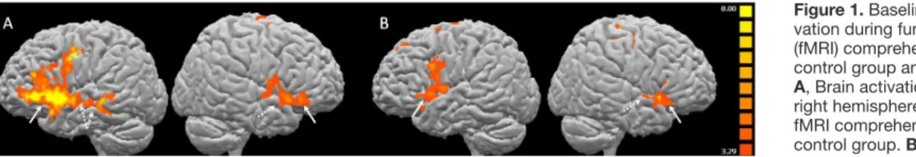 Figure 2. T2 and T3 brain activation during functional MRI (fMRI) tasks. T2 (upper line) and T3 (lower line) activation in Rehab and NRe-