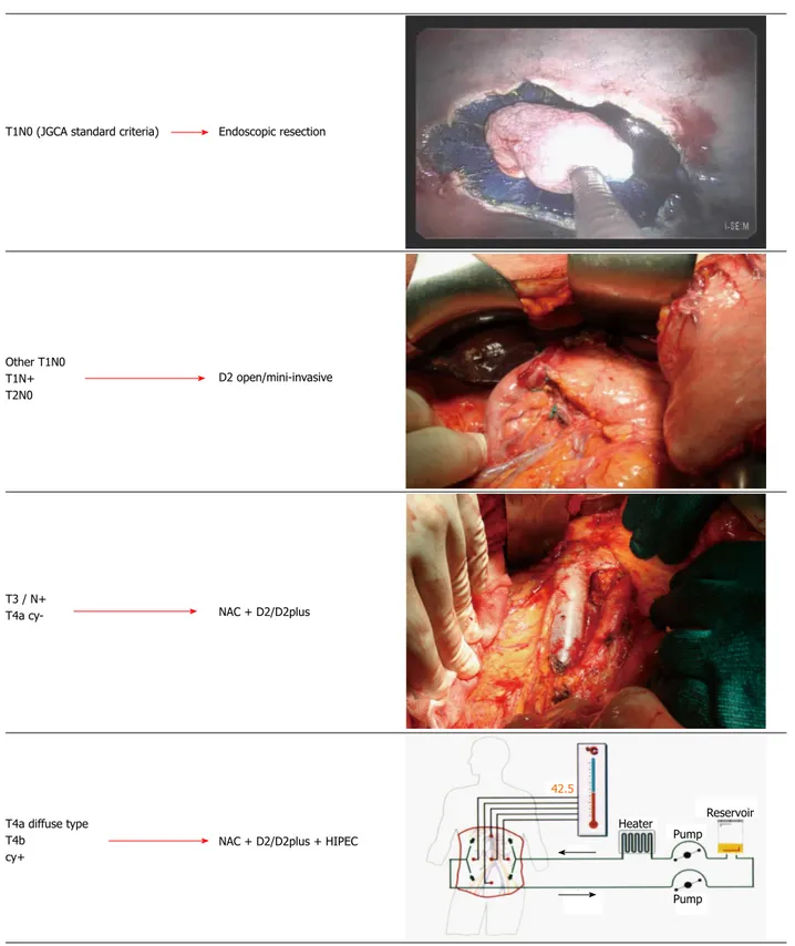 Figure 5  Proposal of a tailored multimodal approach in resectable non-cardiac gastric cancer