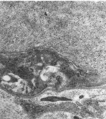 Figure 2. Electron micrograph showing 10-nm immunogold labeling of liver amyloid fibrils with anti–apoA-I antibody.