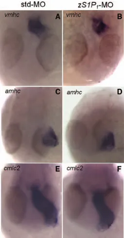 Figure 5.  Effect of the zebrafish ortholog of the endothelial  sphingosine-1-phosphate receptor-1 (zS1P 1 ) knockdown on  car-diac myogenesis gene expression