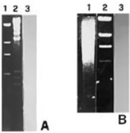 Figure 2. Absence of the plasmid in strain Ep155 of C.parasitica. The nDNA