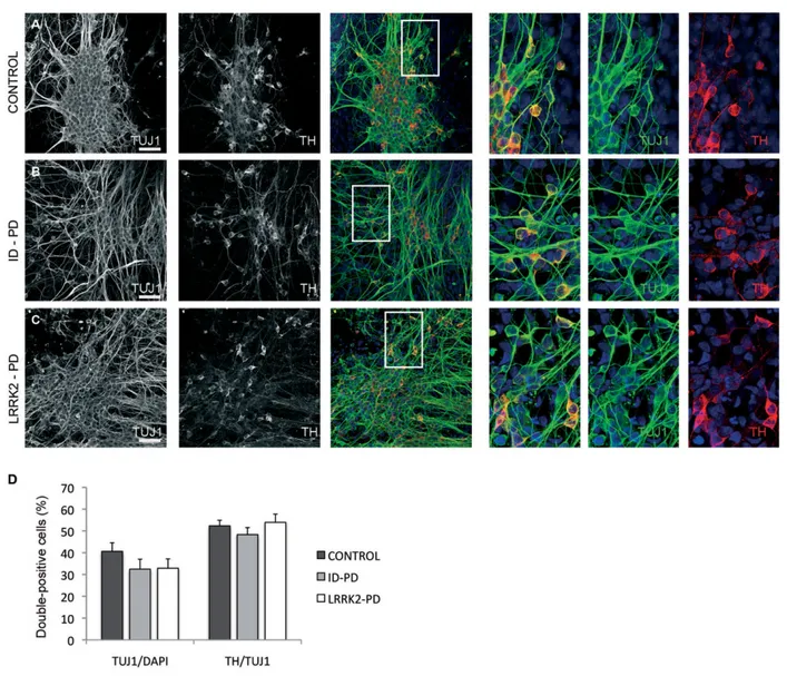 Figure 2. Differentiation of DA neurons from PD patient-specific iPSC. Ctrl-, ID-PD and LRRK2-PD iPSC were differentiated into DA neurons and analysed by immunofluorescence for expression of TUJ1 (green) and TH (red) at the end of the 30-day differentiatio