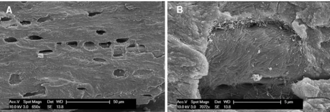 Fig. 5 SEM of the fractured surface of a glycerol-injected specimen (95,982). Torn vessel showing red cells and a polymorphonuclear neutrophil (asterisk) inside the lumen