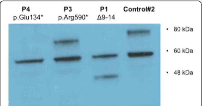 Fig. 1 Functional effects of PRDM5 mutations. Western blot using antibody PRDM5 Ab2 in skin fibroblasts from patients P1 with deletion of exons 9 –14 and P3 with p.Arg590* (described by Burkitt-Wright et al