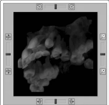 Figure 8 Sagittal section of the maxillary arch displayed in MIP mode: bottom left side view.