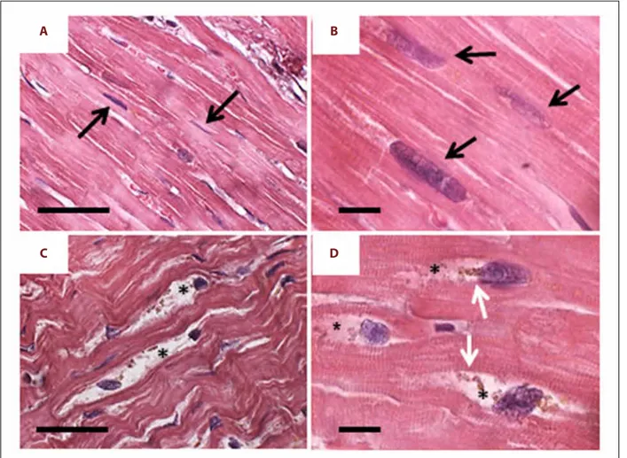 Figure 1.   H and E staining. ( A, B ) Control heart: the cardiomyocytes show regular organization both at lower ( A ) and higher ( B )  magnification