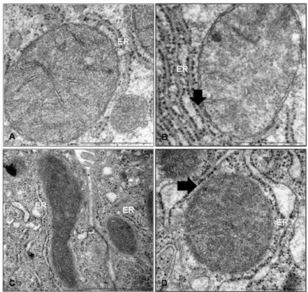 Figure  1.  Mitochondria-associated  endoplasmic  reticulum  membranes  (MAMs)  ultrastructure  in 