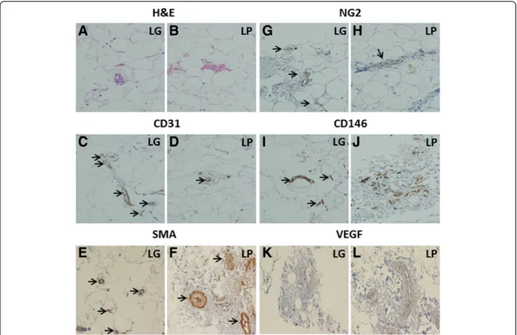 Fig. 1 Histological and immunohistochemical analysis of LG and LP. H&amp;E staining shows higher content of microvessels in LG (a) compared to LP (b)