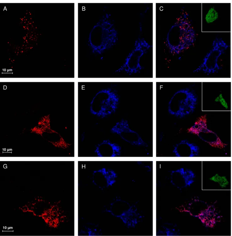 Figure 5. V217A and D234N NEU1 mutant proteins are accumulated in the ER. Confocal microscopy images showing the subcellular distribution of NEU1 wild-type, V217A and D234N mutants