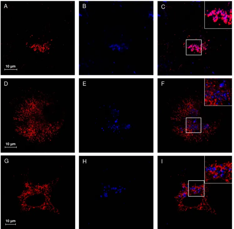Figure 4. Subcellular localization study of V217A and D234N NEU1 mutant proteins. Confocal microscopy images showing the subcellular distribution of NEU1 wild-type, V217A and D234N mutants