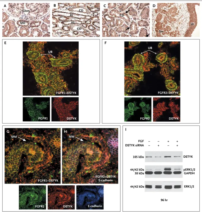 Figure 2.  DSTYK Expression in the Human and Mouse Urinary Tract and Small Interfering RNA (siRNA) Knockdown Studies.