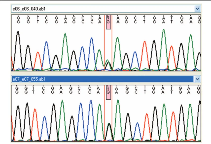 Figure 1. Forward and reverse sanger sequencing result for IFIH1 mutation (c.2471G &gt;A p.Arg824Lys).