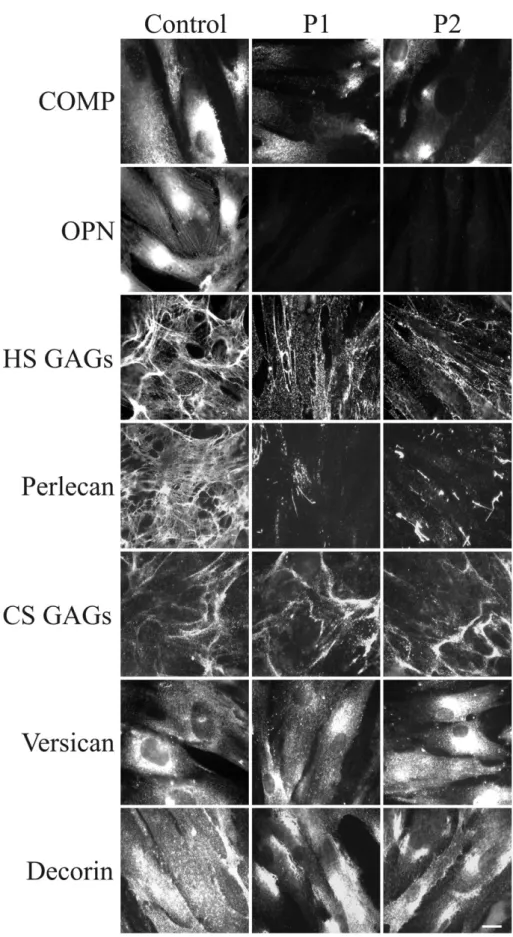 Fig. 5. Organization of COMP, OPN, GAGs, and PGs in SEMDJL1 patients'ﬁbroblasts. Control and GalT-II-deﬁcient (patient 1: P1 and patient 2: P2) skin ﬁbroblasts were analyzed with speciﬁc Abs directed against COMP, OPN, HS, and CS GAGs chains, and the core 