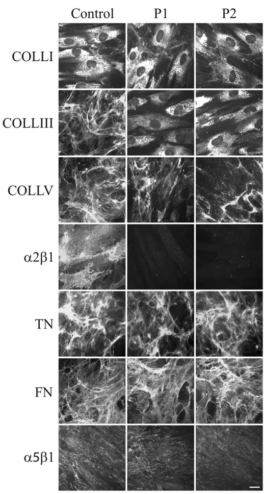 Fig. 6. Organization of COLLs-, TNs- and FN-ECM, and α2β1 and α5β1 integrin receptors