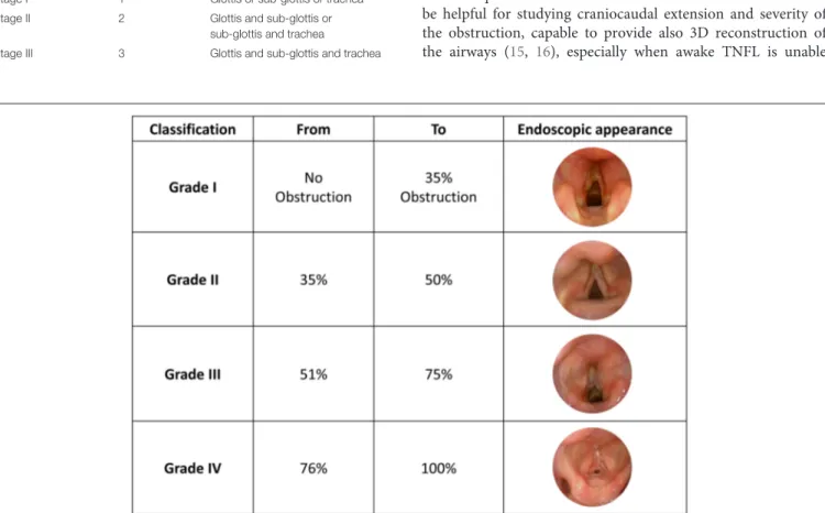 TABLE 1 | Lano-Netterville classification Lano et al. ( 7 ). N. of involved subsites Subsites