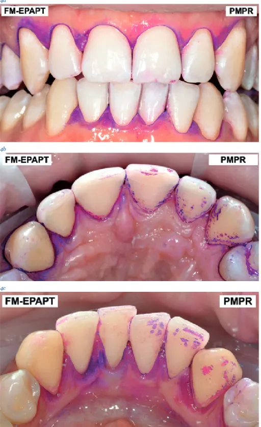 Fig. 4a-c   Si noti la differenza dei residui a seconda del trattamento. a) Foto 
