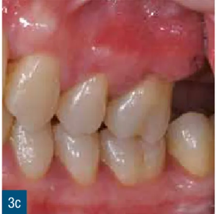 Fig. 4 Status radiografico del paziente.