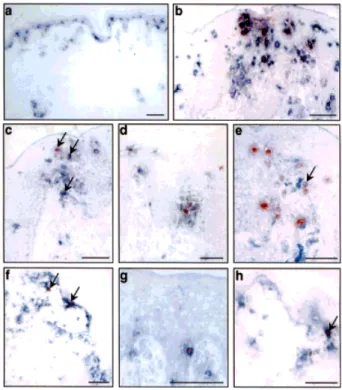 Fig. 7. Expression of MDC in atopic dermatitis and allergic contact dermatitis. Sections from normal human skin (a), atopic der-
