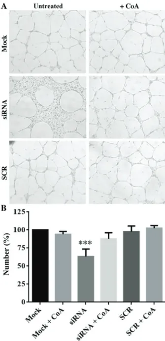 Figure 3. Silencing of PANK2 reduces the wound healing capability of human  umbilical vascular endothelial cells