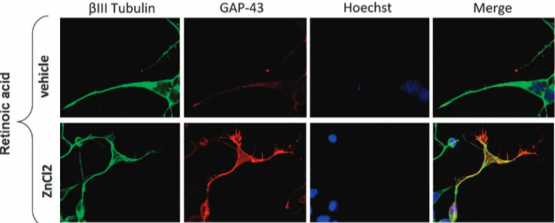 Figure 7 ZnCl 2 restored RA-induced growth cone in SY5Y-APP cells. Cells were treated with 10 m M RA for 48 h