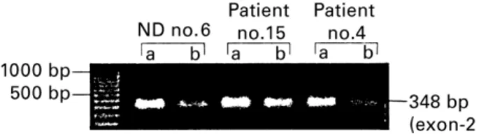 Figure 4 reports the cytofluorimetric pattern of two patients from each group and gives an example of the suppressive effect of Nef on these cells, which was higher than 50% in the CD8 þ population of both patients with severe CD4 þ lymphopenia (section a)