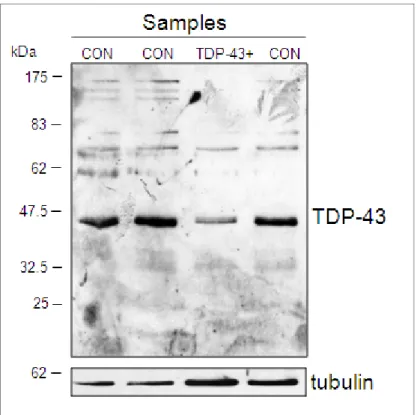 Figure 3. Western blot analysis of N267S lymphoblastoid cell line from  patient and controls