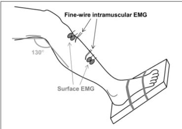 FIGURE 1 | The experimental setup. Two pairs of fine-wire intramuscular EMG electrodes were inserted in the proximal and distal regions of the tibialis anterior muscle