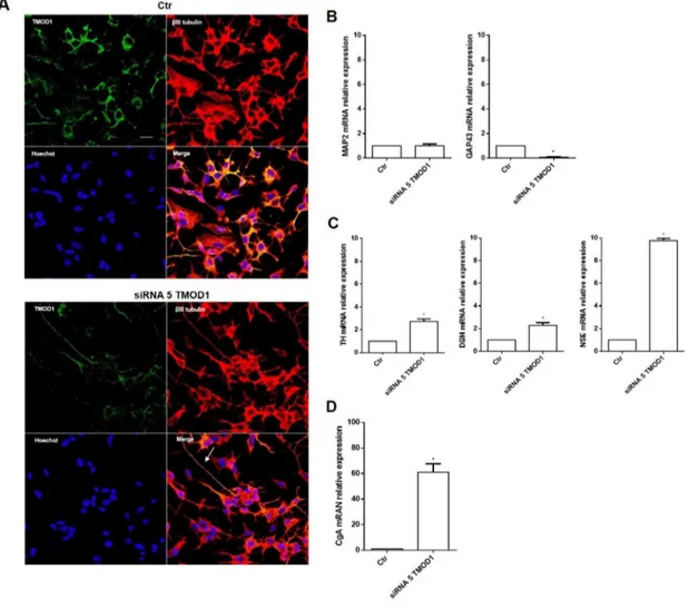 Figure 6: TMOD1 knockdown induces in neuroblastoma cells a neuroendocrine differentiation profile