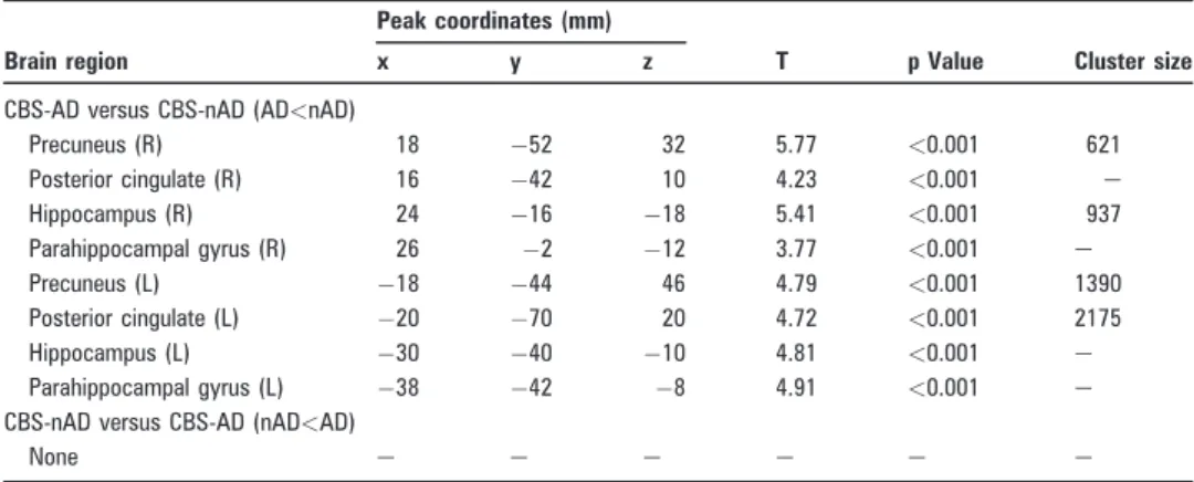 Table 3 Location of the peaks of reduction of regional cerebral blood flow in corticobasal syndrome with CSF AD-like pattern compared with nAD-like pattern