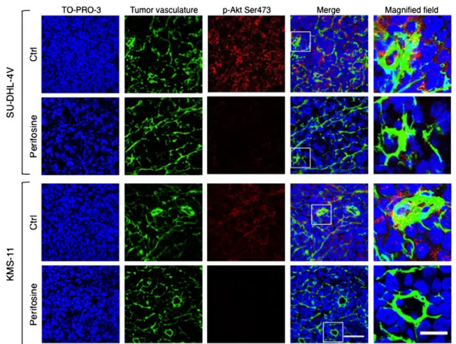Fig. 2 In vivo perifosine-induced inhibition of Akt phosphorylation in tumor cells and tumor vasculature