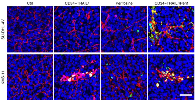 Fig. 5 Perifosine-induced DR5 expression by tumor vasculature sensitizes TECs to CD34-TRAIL 1 cells-induced apoptosis