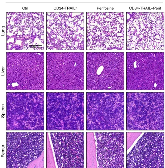 Fig. S4 Tumor cells differentially affect TECs phenotype