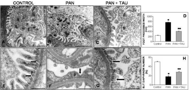 Figure 1. Podocyte damage. Dietary TAU reduced podocyte damage in PAN. Transmission electron 