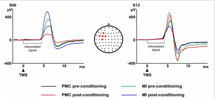 FIGURE 3 | P5 and N8 pre- and post-primary motor cortex (MI) or premotor cortex (PMC) conditioning as recorded from the marked electrodes