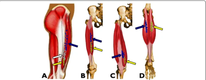 Figure 3 Position of the muscle motor points for the quadriceps and gastrocnemii in 53 healthy subjects