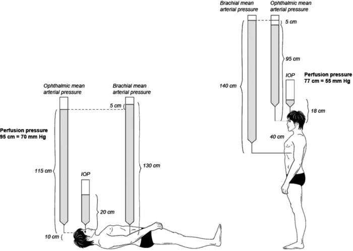 Fig. 3. Hydrostatic column effect of postural position on blood pressure and ocular perfusion pressure