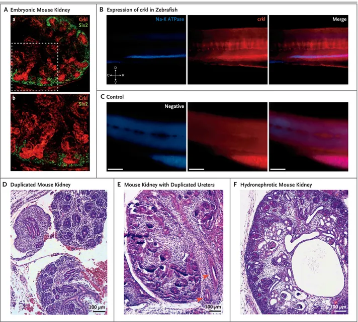 Figure 3. Localization of Crkl in Developing Urinary Tracts in Mice and Zebrafish and Phenotypes of Crkl Knockout Mice.