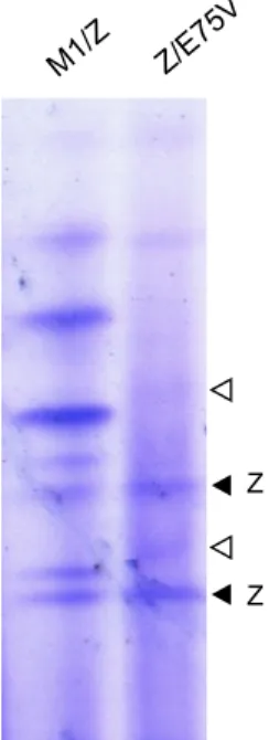 Fig. 1. Phenotyping of the AAT Trento variant. An IEF analysis (over the pH range 4.2 –4.9) was performed on the proband’s plasma compared with that of a known M1Z heterozygote
