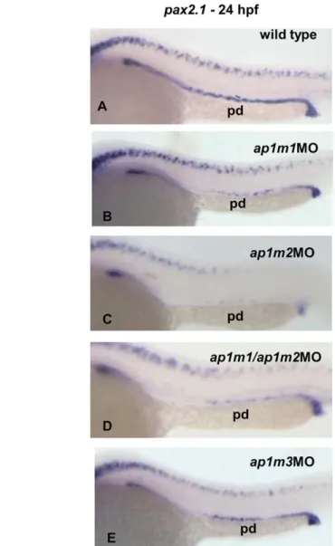 Fig. 8. A–E: Effects of m1 knockdowns on pax2.1 expression. At 24 hpf, wild-type embryos, single and double morphants were analyzed by WISH for pax2.1 expression