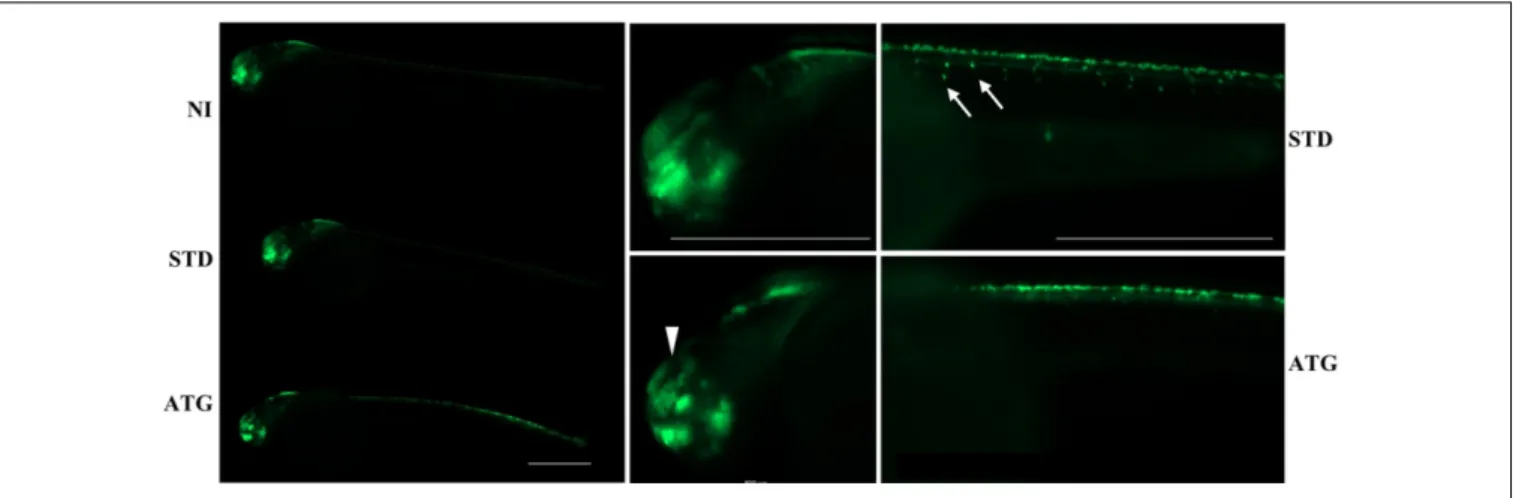 FIGURE 4 | neurog1-dependent EGFP fluorescence in embryos injected with control (STD) or ATG morpholinos
