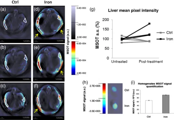 Fig. 5 In vivo and ex vivo photoacoustic analysis of the liver of iron-loaded and control mice