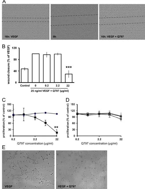 Fig. 4. Effect of Q797 on different in vitro steps of the angiogenic process. (A) Effect of Q797 on endothelial cells migration in vitro